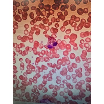 Korepetycje do Matury 2027 z chemii i biologii - Udzielam korepetycji - Gdańsk - zdjęcie 4